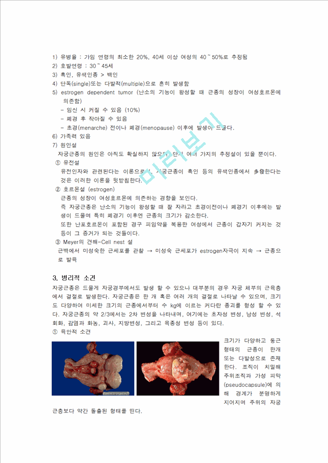 [모성간호학] 자궁근종 사례 연구.hwp